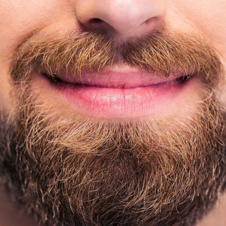 Transplante de Barba e Bigode