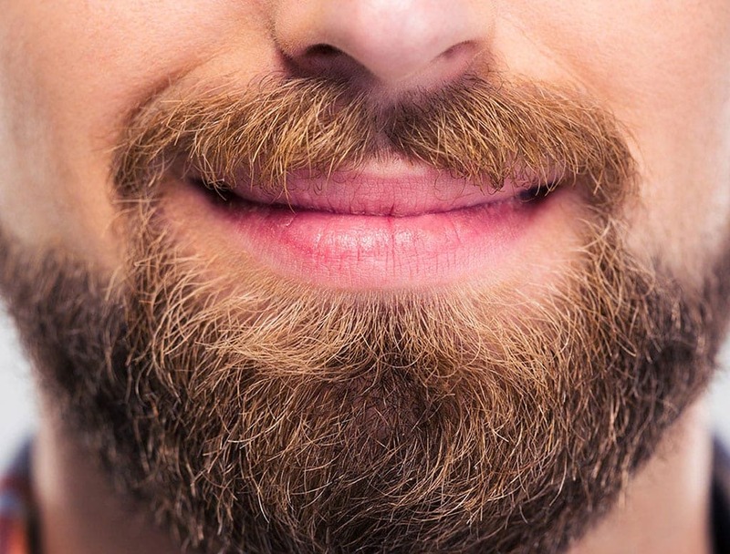 Transplante de Barba e Bigode